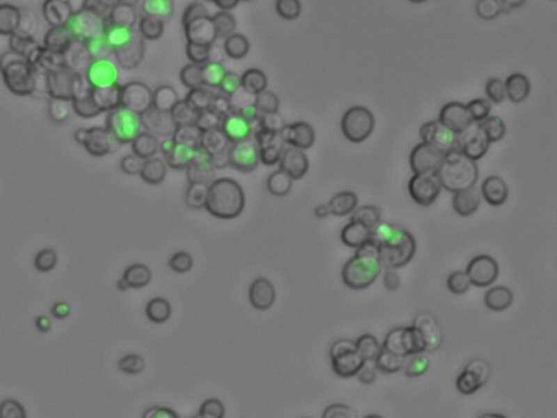 Picture of yeast sytox
