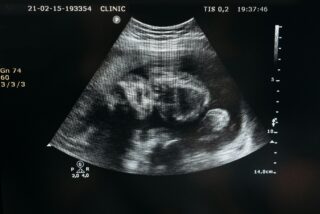 Sonogram image
