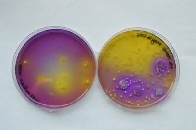 My hand (left) & a student's hand (right)...someone needs to wash their hands more.