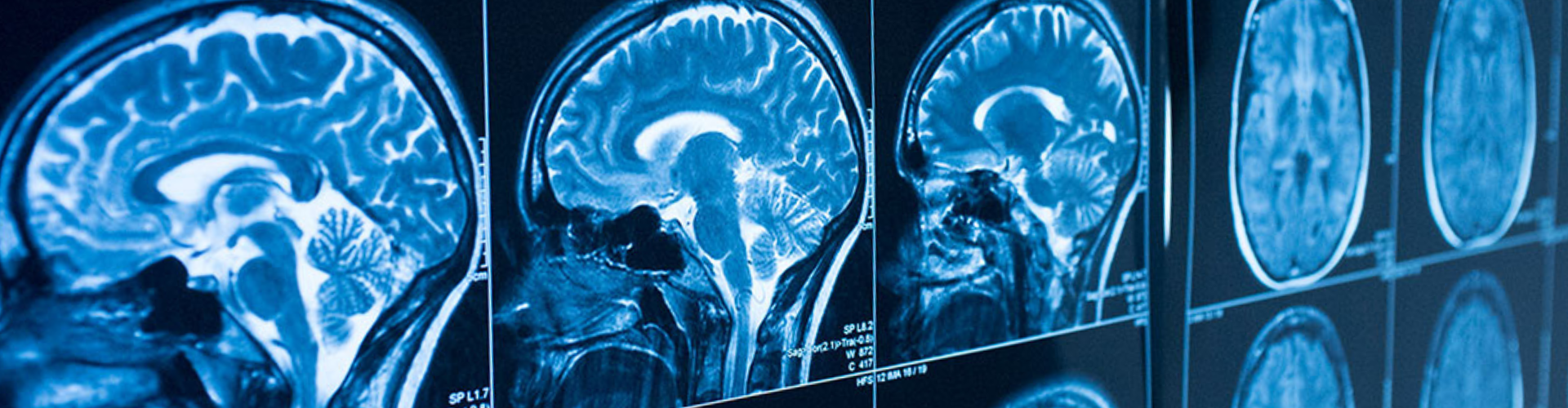 Scans of brain activity.