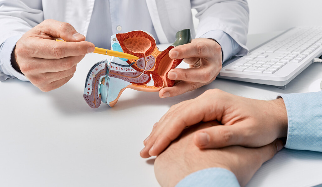 Male reproductive system anatomical model in doctors hands close-up during consultation of male patient.