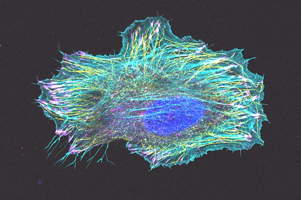 Microscopic image of a cell structure related to Epidermolysis Bullosa.