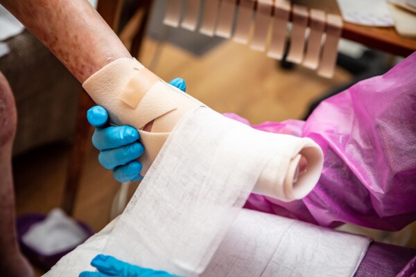 A nurse applies a bandage to a foot with epidermolysis bullosa.