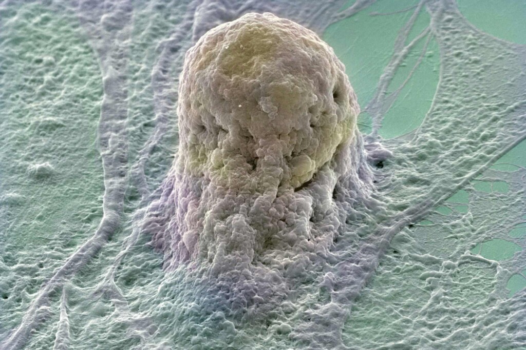 A human embryonic stem cell, stem cells are derived from very early embryos.