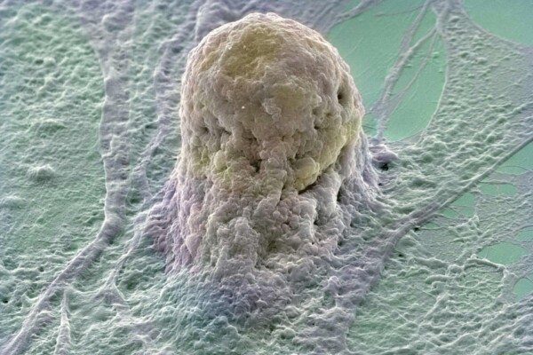 A human embryonic stem cell, stem cells are derived from very early embryos.