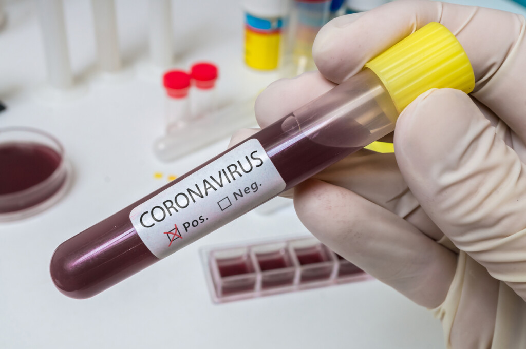 Hand holds test tube for Coronavirus