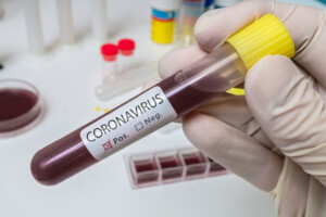 Hand holds test tube for Coronavirus