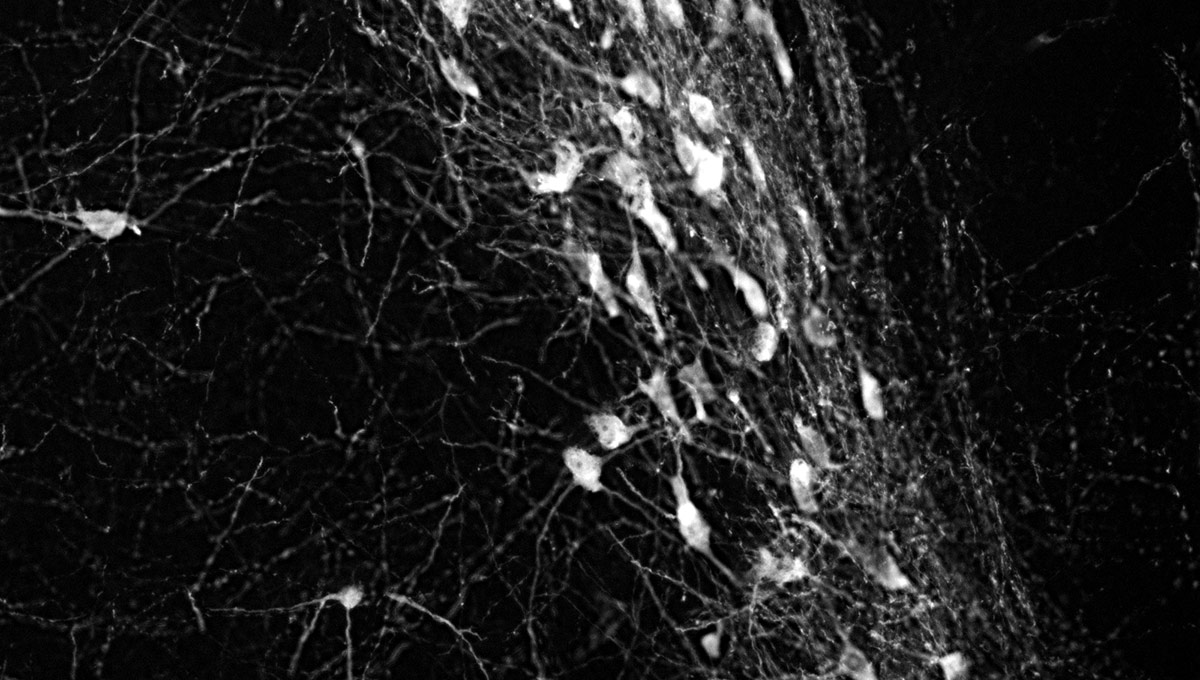 Solving the Parkinson's Puzzle