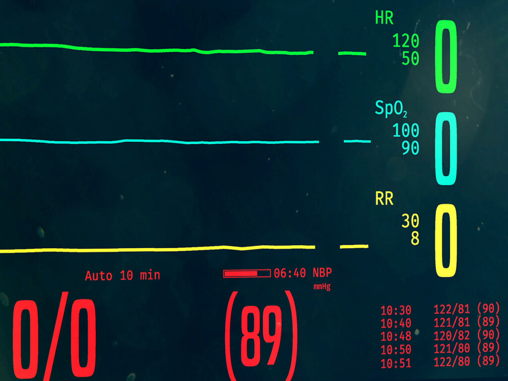 Flatline on a heart rate monitor