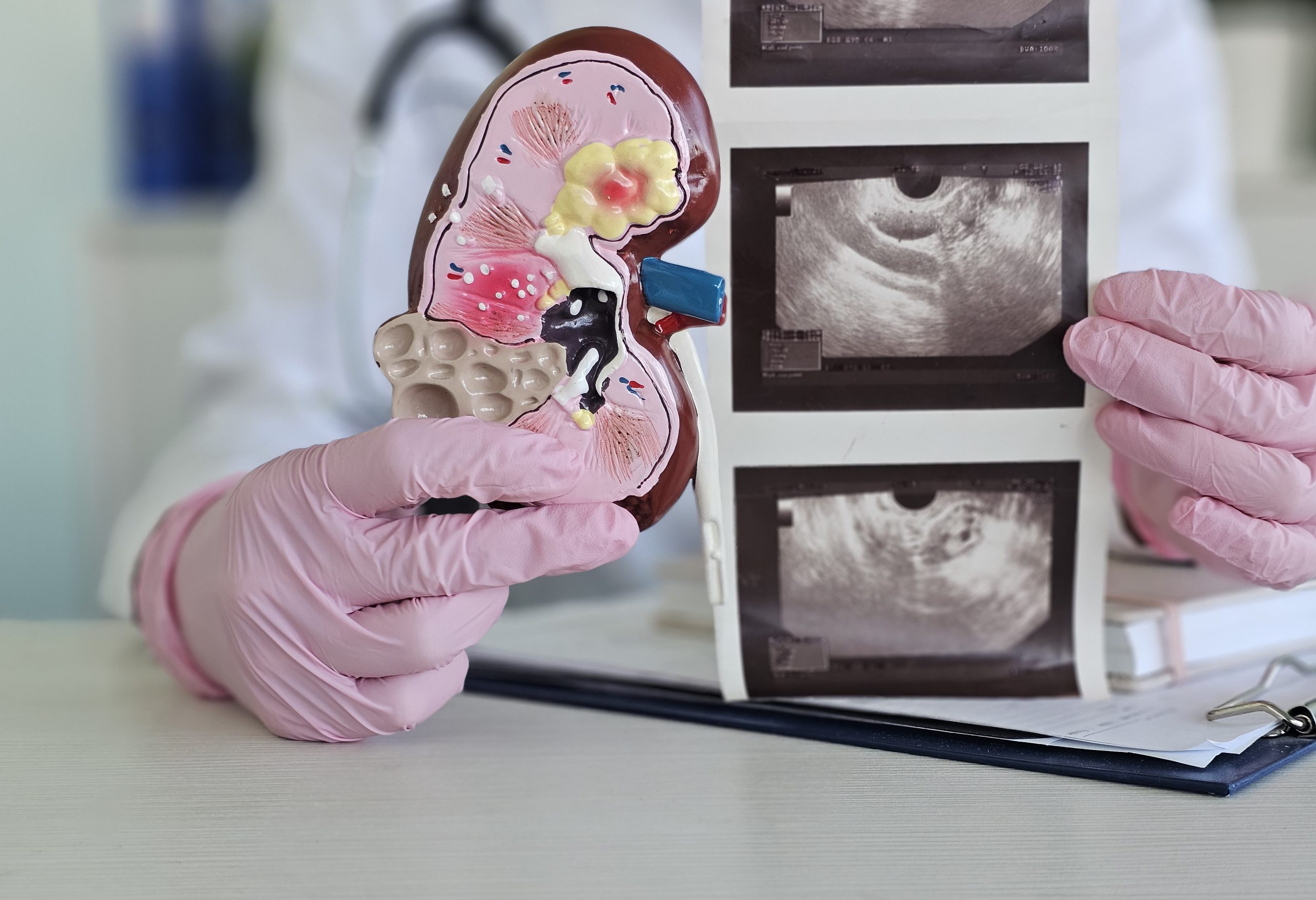 Kidney ultrasound with model kidney beside the results.